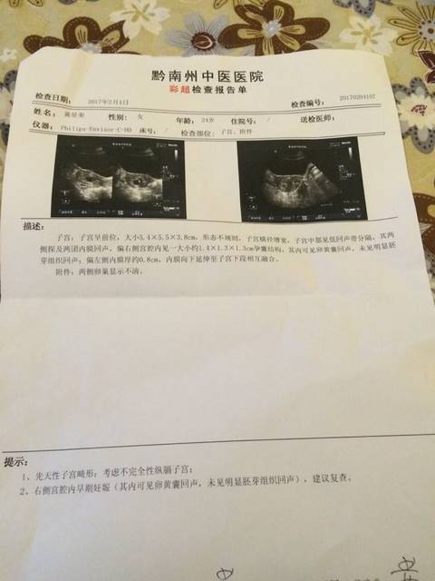 孕34天经历流褐色血,大出血。_备孕一年,一年