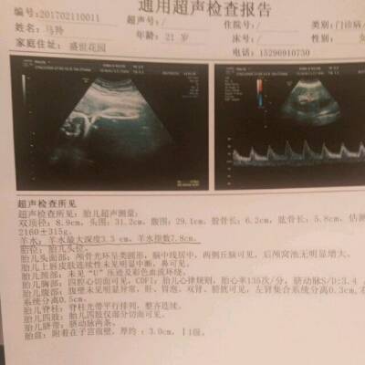 怀孕37周,检查时羊水偏少,胎儿偏小3周,现在才