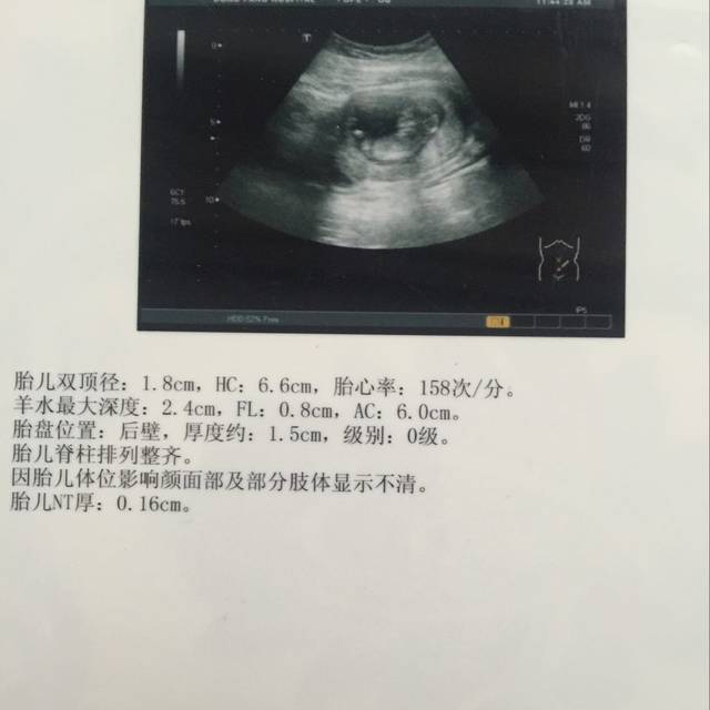 发三个月时b超图帮你看男孩女孩