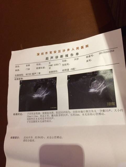 怀孕八周多了都没有胚芽回音及胎心回音,医生