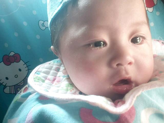 宝宝眼睛是怎么了?_长眼屎,眼白有红血丝_宝宝