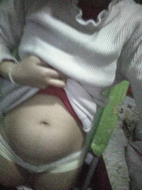 肚子大小正常吗_今天17周+的肚子,这个大小正