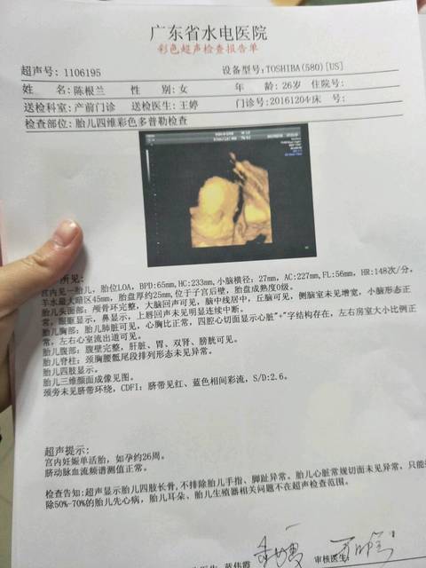 四维彩超数据看男女_以下是我四维彩超的数据