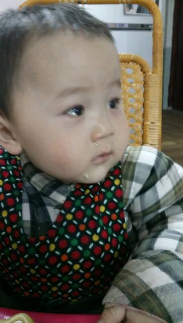 宝宝眼屎多怎么办, 急_宝宝十个月了昨天左眼