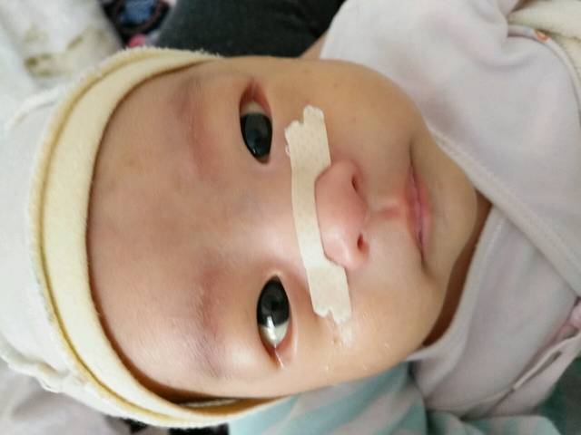 宝宝感冒鼻塞怎么办?_大宝前几天感冒了,流鼻