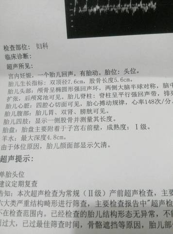 双顶径和股骨长判断男女_双顶径和股骨长判断