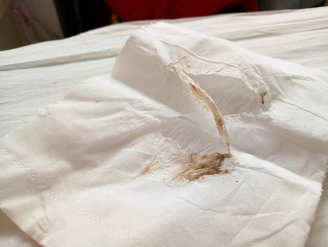 37周+2有咖啡色分泌物怎么办_今天37周+2正