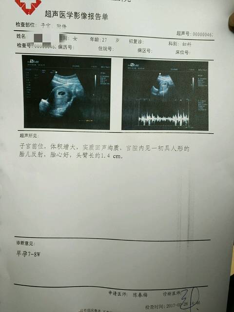 接好孕的来,刚刚拿到B超报告单见胎心胎芽
