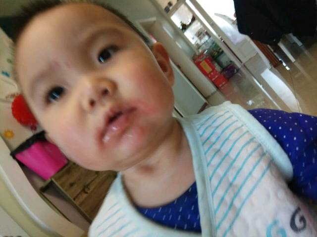 我家宝宝嘴角红痒怎么办_我家宝宝十一个月了