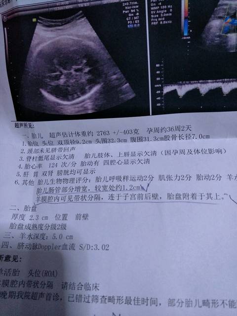 助求助求助_今天去做B超,结果显示胎儿肠管部