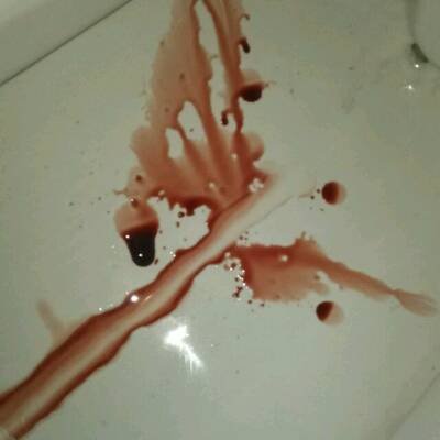 你好,怀孕40多天,之间吃了好多螃蟹,还同房了,