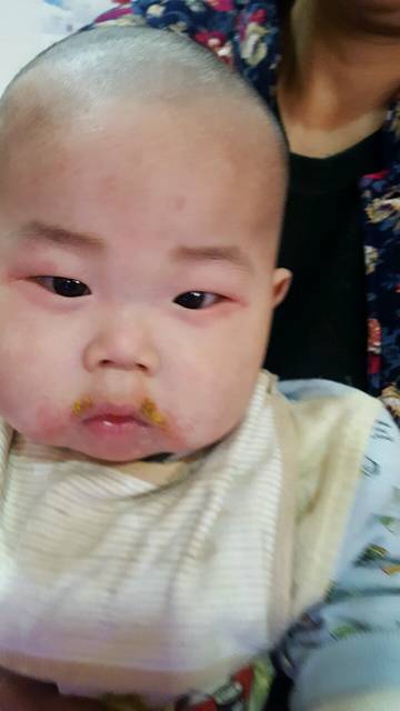 有宝宝吃米粉过敏吗?