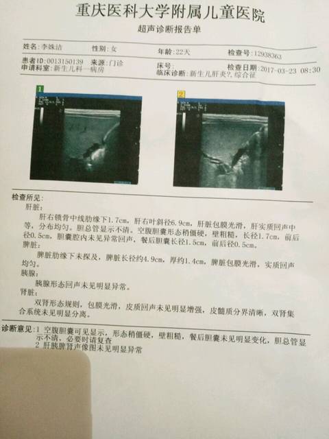 跪求肝炎综合症和胆道闭锁的症状_我家宝宝出