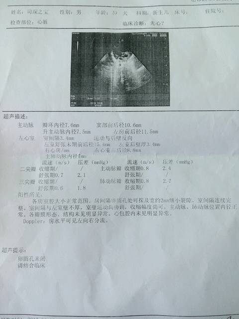 宝宝20天,泪囊炎,心脏卵圆孔未闭2mm,求助_宝