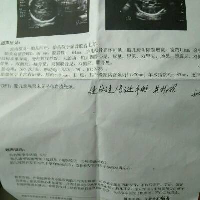 孕36周了,B超单显示胎儿双顶径发育相当于孕