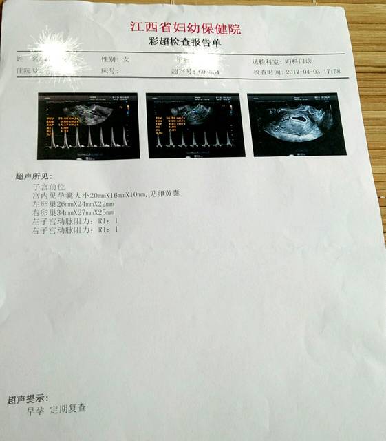 孕五周多的宝妈帮忙看下这个B超单_做的腹部