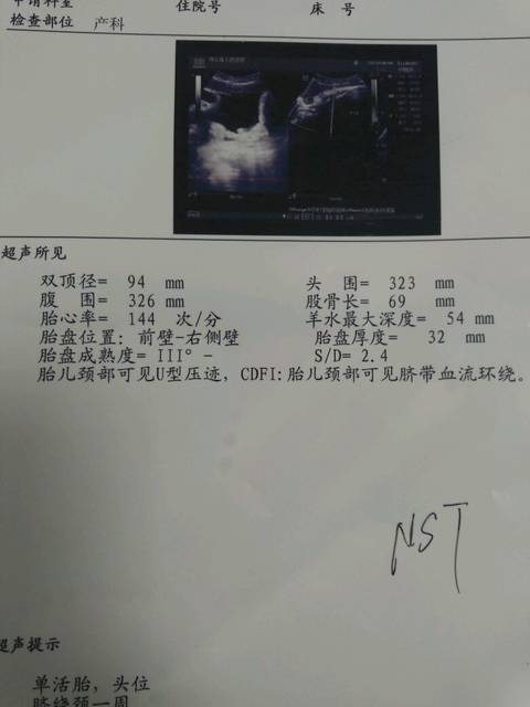求助宝妈们_37+3周 b超了 胎盘成熟度3级减,还