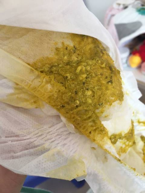 谁能告诉我宝宝的粑粑里面这是什么啊~