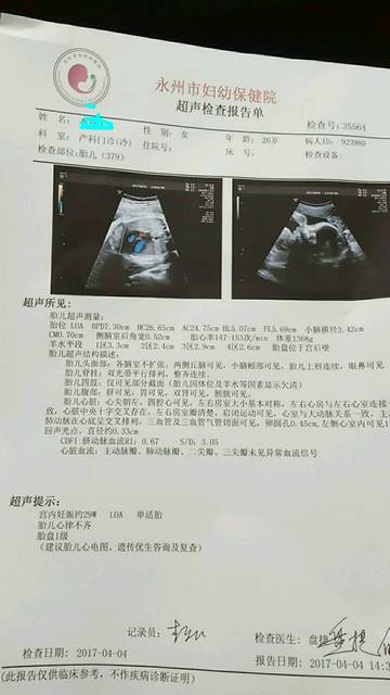 孕29w 第二次四维 胎儿心率不齐_孕28周的时候
