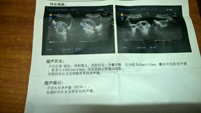 新人报道,请多关照_怀孕一个月多月了,前几天