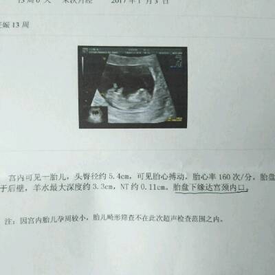我怀孕三个月,去医院检查,医生说胎盘低于宫口