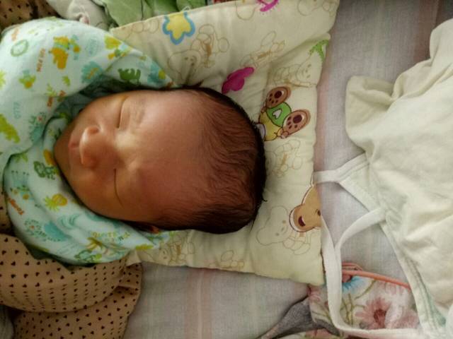 头上有个软包正常吗?_宝宝生下来头上有个软