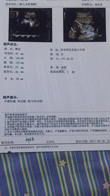 怀孕一个月,知道宝宝性别_第一次BC图片,四维