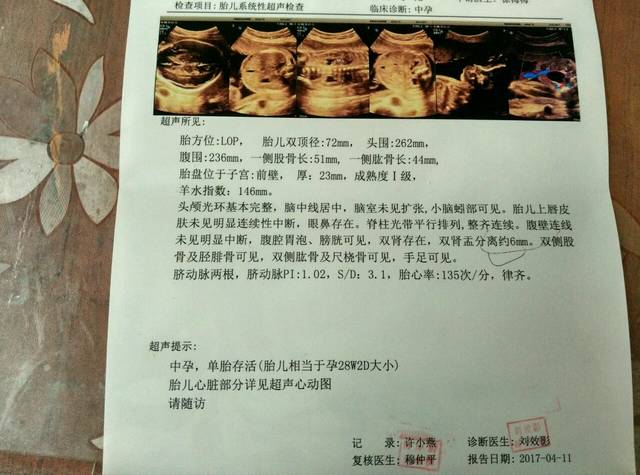 左右心室强光点怎么办_左右心室强光点怎么办