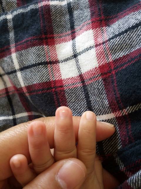 宝宝指甲有白点_我家宝宝三个月了,指甲有白点