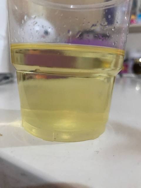 宝妈们帮忙看看是男孩还是女孩_酒精测男女,二