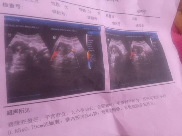 亲们 赶快给我说一下_怀孕38天 宫内可见大小