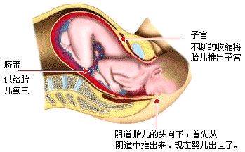 分娩方式与宝宝的未来_ 在顺产和剖腹产对宝宝