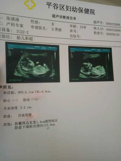 希望翻盘女宝宝_今天怀孕三个月比超,他们说又