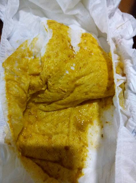 帮我看看45天宝宝的便便正常不,纯母乳