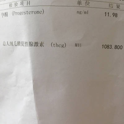 怀孕5周4孕酮值跟绒毛膜促性腺激素值谁可以帮忙看看是否标准