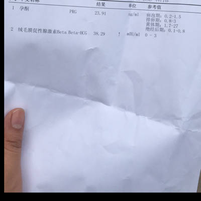 意外怀孕,纠结要不要,我们刚领证,婚礼还没举办