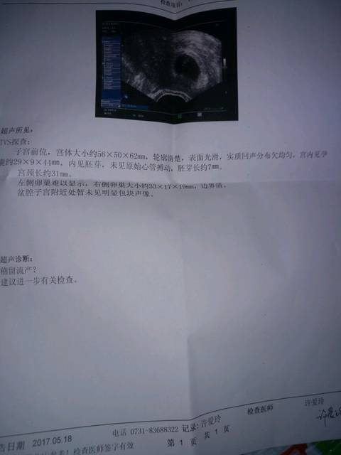 末次4.1,48天查不到胎心胎芽,有一样的么_整个