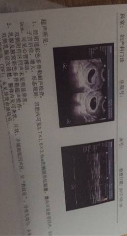 我这个孕囊形状,医生说可能是个男宝,叫我生的时候对照看看准不准