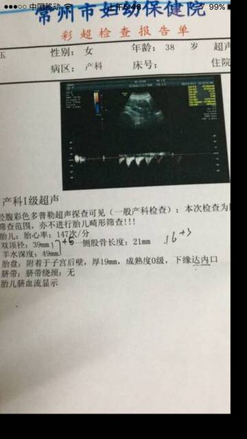 怀孕18周+5流血_胎儿双顶径41mm胎儿心率1