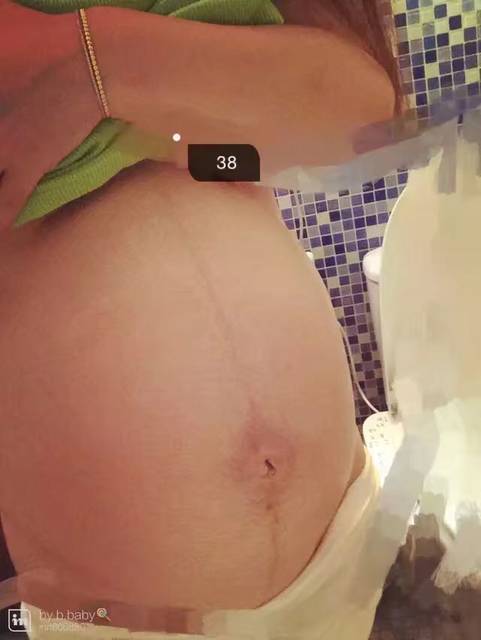 一胎女宝,二胎男宝,生男生女的肚子!