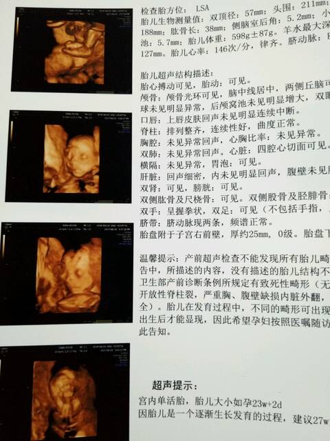求高手看女孩女生_四维顺利惩罚,求宝妈男孩看a高手的最高手通过图片