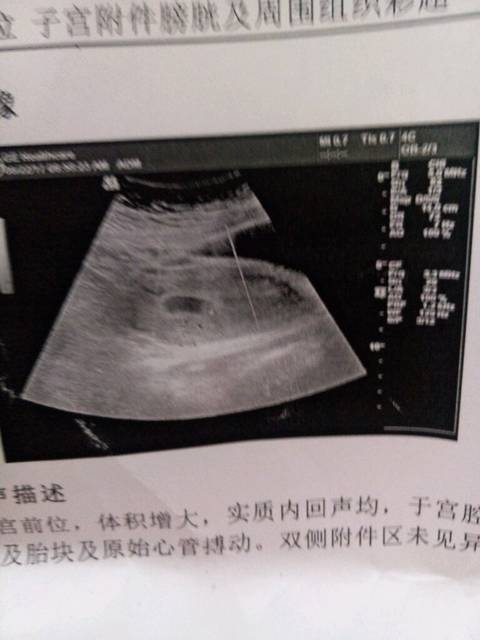 看男女_孕七周做b超孕囊2.5\/1.4姐妹们男孩