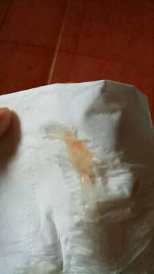 38周 ,上厕所,擦出血丝,这是见红吗,早上断断续续流了
