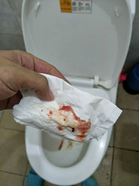 怀孕七个多月下面有血