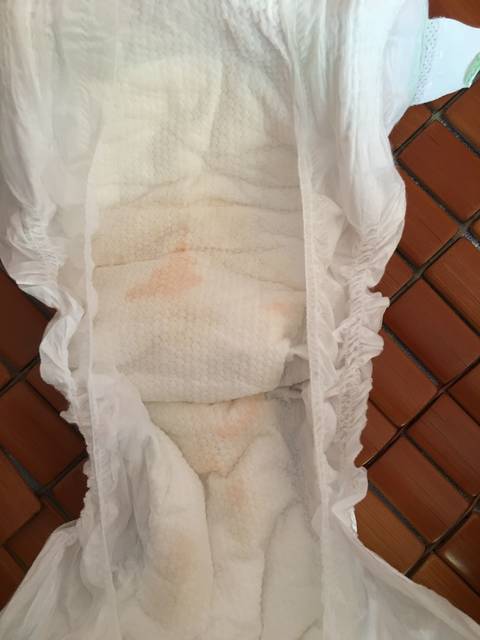 女宝宝尿有点砖红色怎么回事_今早给宝宝换尿