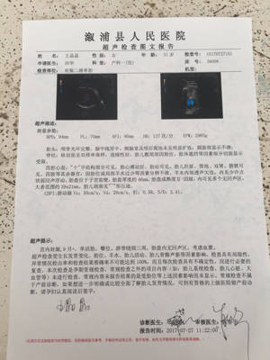 今天检查b超显示宝宝脐带绕颈三周,臀位,现在我的孕周是36 2,我想37周