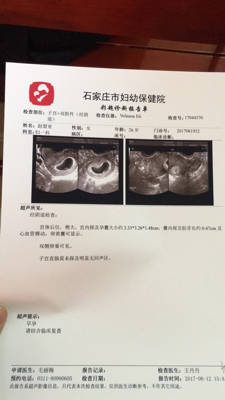 怀孕6周,今天刚做了阴超,医生建要吃2片叶酸,吃到12周,请帮忙看下结果