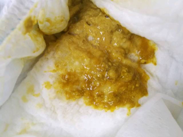 们看图,快快帮我想办法啊!_快三个月的宝宝拉