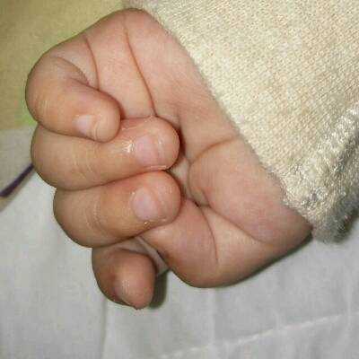 宝宝四个月零8天了,有时候能打开手指有时候握