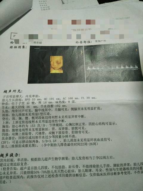 如果生男宝,四维单子 就看出来了
